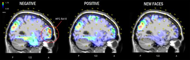 figura-2-le-basi-neurali-del-pregiudizio