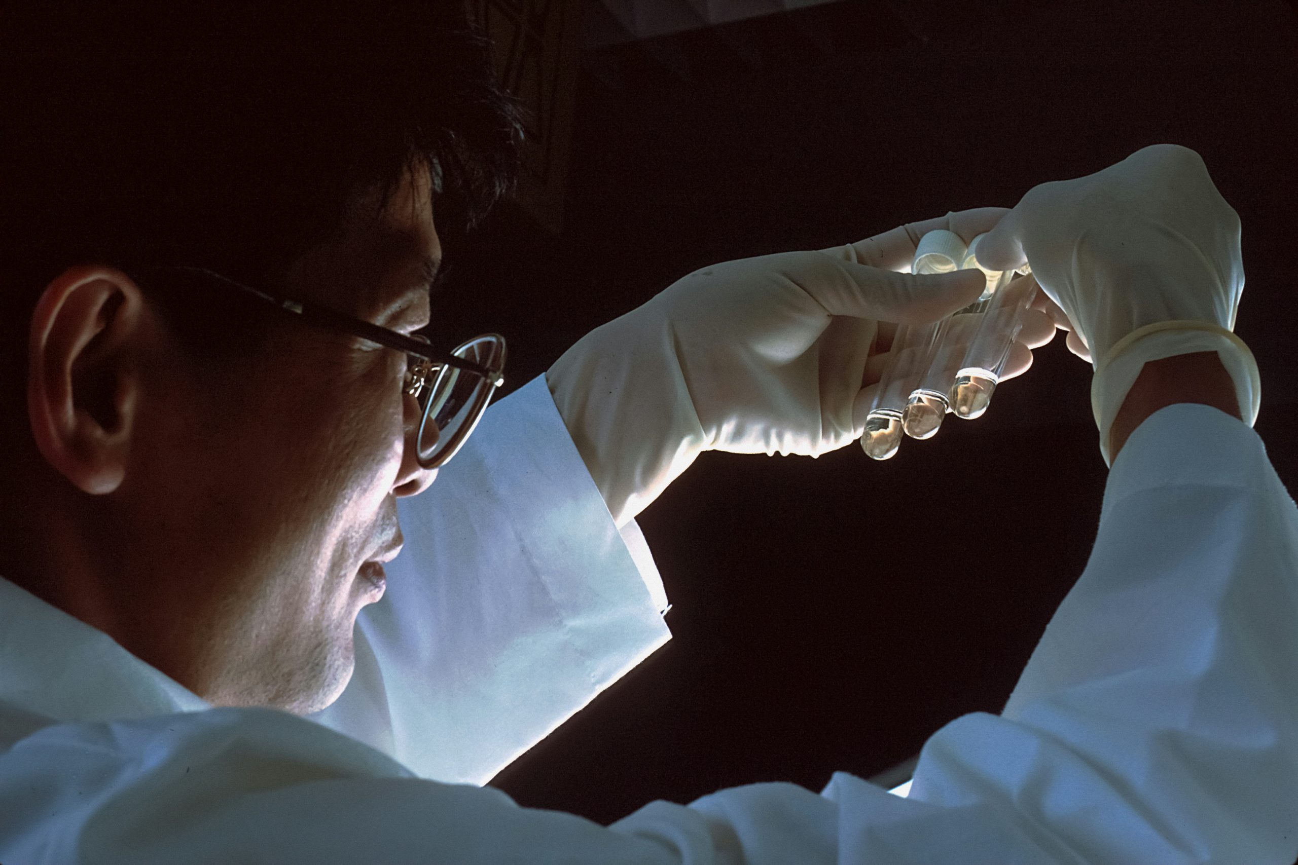 HIV AIDS ricerca